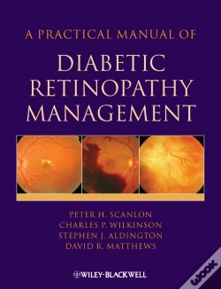 Capa do artigo Practical Manual Of Diabetic Retinopathy Management