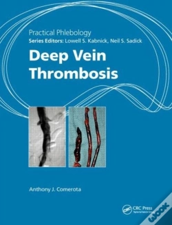 Capa do artigo Practical Phlebology