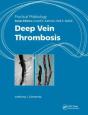 Practical Phlebology - Preview