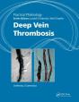 Practical Phlebology - Preview