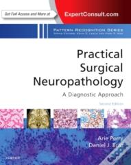 Practical Surgical Neuropathology: A Diagnostic Approach