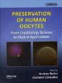 Preservation Of Human Oocytes - Preview