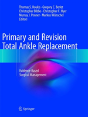 Primary And Revision Total Ankle Replacement - Preview