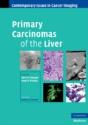 Primary Carcinomas Of The Liver - Preview
