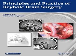 Principles And Practice Of Keyhole Brain Surgery
