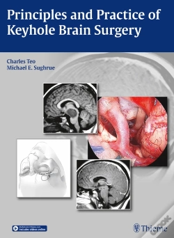 Capa do artigo Principles And Practice Of Keyhole Brain Surgery