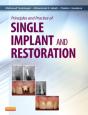 Principles And Practice Of Single Implant And Restoration - Preview