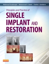 Principles And Practice Of Single Implant And Restoration