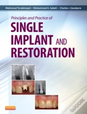 Capa do artigo Principles And Practice Of Single Implant And Restoration