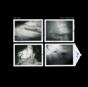 Proofs and Refutations - Vinil - Preview