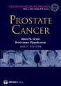 Prostate Cancer - Preview