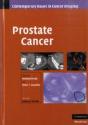 Prostate Cancer - Preview