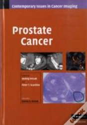 Capa do artigo Prostate Cancer
