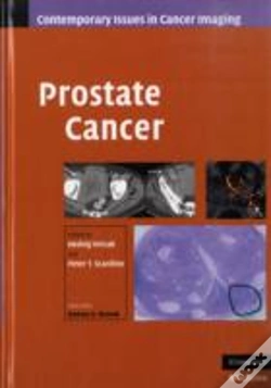 Capa do artigo Prostate Cancer