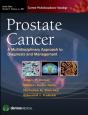 Prostate Cancer - Preview