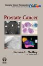 Prostate Cancer - Preview