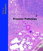 Capa do artigo Prostate Pathology