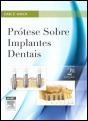 Prótese sobre Implantes Dentais - Preview