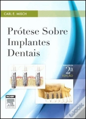 Capa do artigo Prótese sobre Implantes Dentais