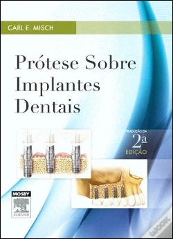 Capa do artigo Prótese sobre Implantes Dentais