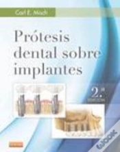 Capa do artigo Prótesis Dental Sobre Implantes (2ª Ed.)