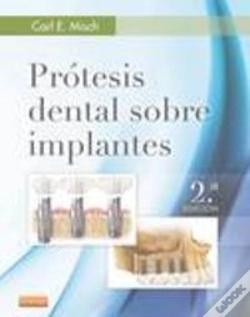 Capa do artigo Prótesis Dental Sobre Implantes (2ª Ed.)
