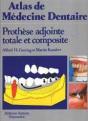 Prothese Adjointe Totale Et Composite - Preview
