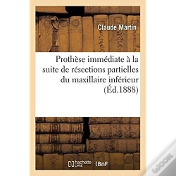 Capa do artigo Prothese Immediate A La Suite De Resections Partielles Du Maxillaire Inferieur