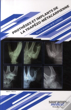 Capa do artigo Prothèses Et Implants De La Trapézo Métacarpienne