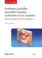 Prothèses Partielles Amovibles Simples, Combinées Et Sur Implants ; Nouveaux Regards, Nouvelles Conceptions - Preview