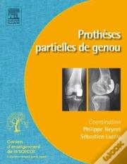 Prothèses Partielles Du Genou