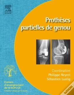 Capa do artigo Prothèses Partielles Du Genou