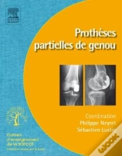 Capa do artigo Prothèses Partielles Du Genou