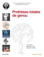 Prothèses Totales De Genou - Preview