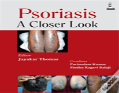 Psoriasis