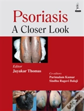 Psoriasis