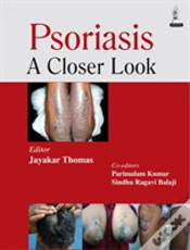 Capa do artigo Psoriasis