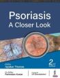 Psoriasis - Preview