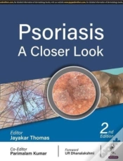 Capa do artigo Psoriasis