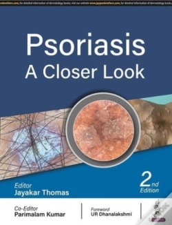 Capa do artigo Psoriasis