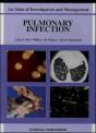 Pulmonary Infection - Preview