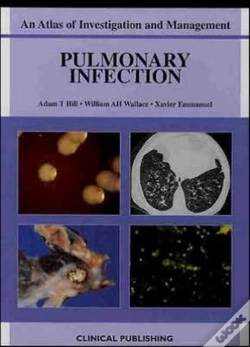 Capa do artigo Pulmonary Infection