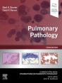 Pulmonary Pathology E-Book - Preview