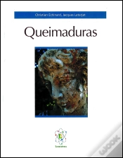 Capa do artigo Queimaduras