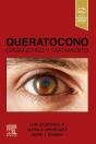 Queratocono - Preview