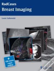 Capa do artigo Radcases Breast Imaging