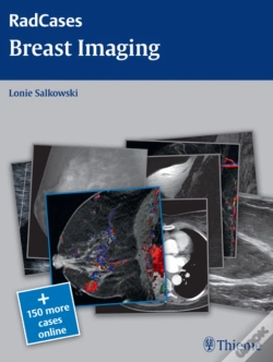 Capa do artigo Radcases Breast Imaging