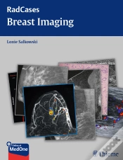 Capa do artigo Radcases Breast Imaging