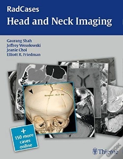 Capa do artigo Radcases Head And Neck Imaging