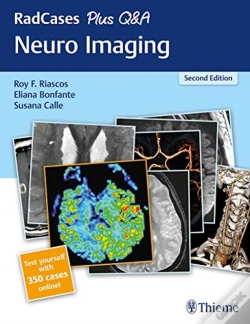 Capa do artigo Radcases Plus Q&A Neuro Imaging